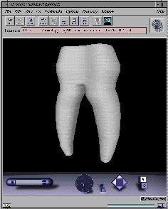 A tooth model rendered with Nuages